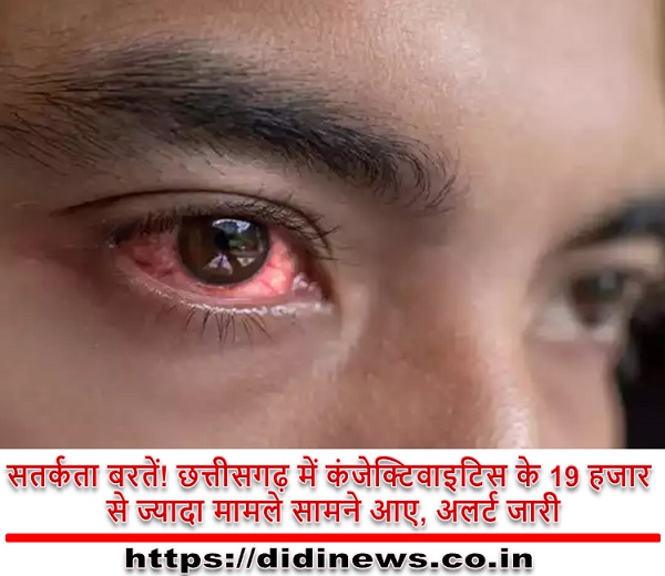 सतर्कता बरतें! छत्तीसगढ़ में कंजेक्टिवाइटिस के 19 हजार से ज्यादा मामले सामने आए, अलर्ट जारी