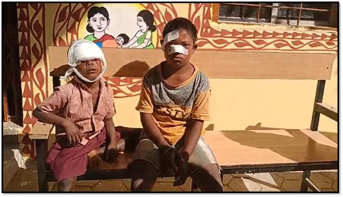 कुत्ते की हमले में घायलों की हालत गंभीर, कुत्ते का आतंक जारी