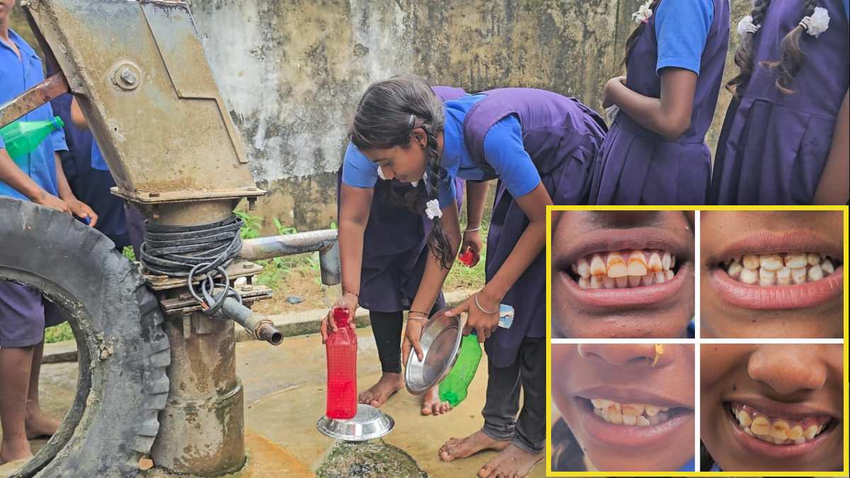 40 गांवों के स्कूलों में फ्लोराइड रिमूवल प्लांट बंद, 2 हजार बच्चों की सेहत पर मंडरा रहा खतरा, सुध लेने नहीं आ रहे जिम्मेदार