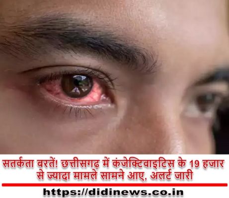 सतर्कता बरतें! छत्तीसगढ़ में कंजेक्टिवाइटिस के 19 हजार से ज्यादा मामले सामने आए, अलर्ट जारी
