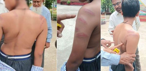 बेरहम शिक्षक: टीचर ने छात्र को बेसुध होने तक डंडे से पीटा, नोट्स न लिखने पर दिया गहरा जख्म, परिजनों ने की कार्रवाई की मांग