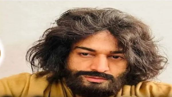 अनुपमा के अनुज को ये क्या हुआ, लुक देखकर फैंस को होने लगी चिंता