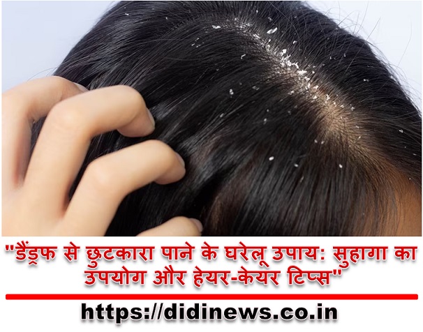 "डैंड्रफ से छुटकारा पाने के घरेलू उपाय: सुहागा का उपयोग और हेयर-केयर टिप्स"