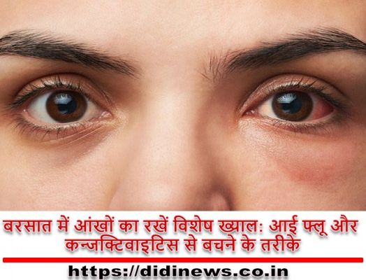 बरसात में आंखों का रखें विशेष ख्याल: आई फ्लू और कन्जक्टिवाइटिस से बचने के तरीके