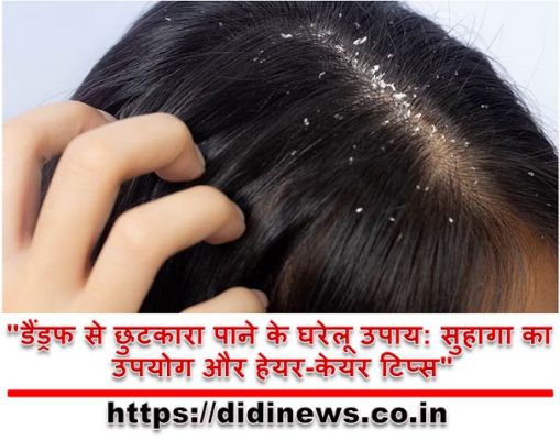 "डैंड्रफ से छुटकारा पाने के घरेलू उपाय: सुहागा का उपयोग और हेयर-केयर टिप्स"