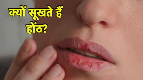 इन कारणों के वजह से बार-बार सूखते हैं होंठ, इस विटामिन की हो सकती है कमी…