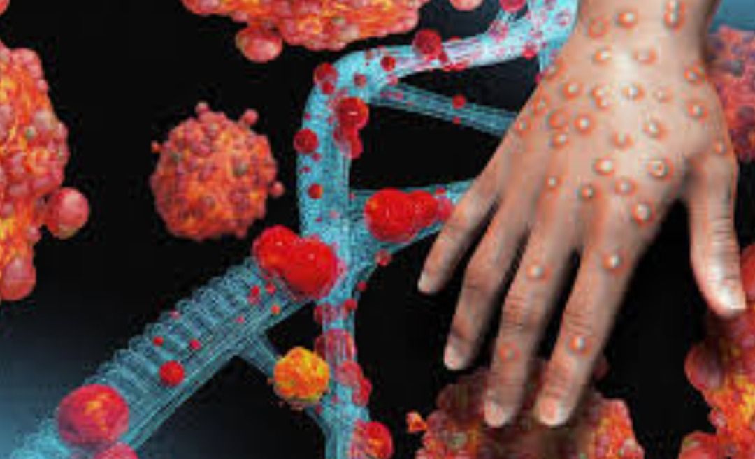 मंकीपॉक्स ने दुनिया में मचाया कोहराम, 100 से ज्यादा की हुई मौत, पाकिस्तान-स्वीडन में भी मिला मरीज, WHO ने ग्लोबल हेल्थ इमरजेंसी का किया ऐलान