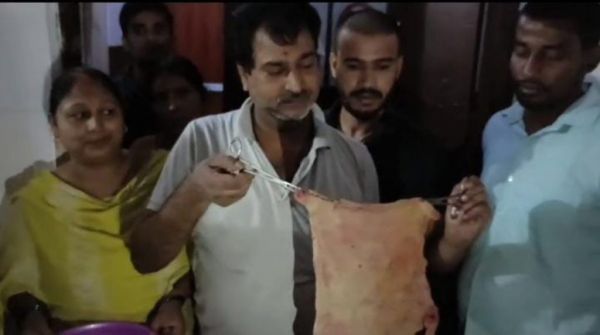  डिलीवरी के बाद घर जाते ही महिला होने लगा पेट दर्द, प्राइवेट अस्पताल में दिखाया तो पता चला सरकारी डॉक्टरों ने कर दिया था बड़ा कांड